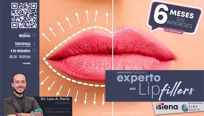 labios